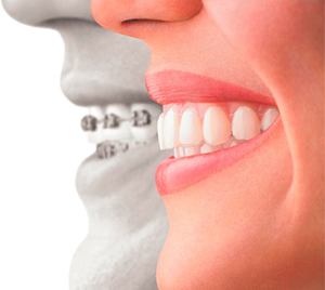 estetica dental barcelona