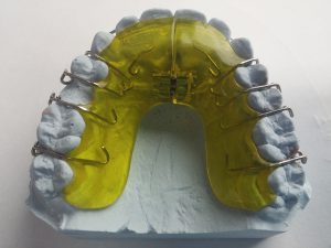 ortodoncia barcelona