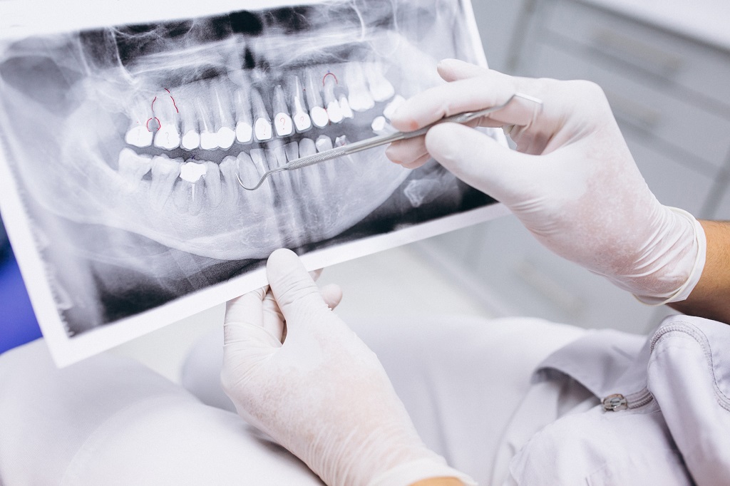 fregar posterior puesta de sol Cirugías dentales más comunes | Sonríe Estudio Dental